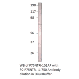 Anti-p75 NGF Receptor Antibody from FabGennix (P75NTR-101AP) - Antibodies.com