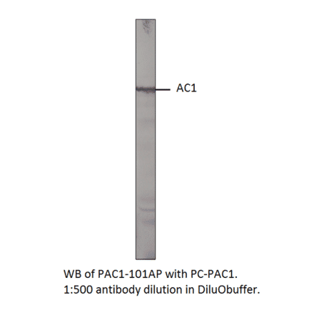 Anti-Adenylate cyclase 1 Antibody from FabGennix (PAC-101AP) - Antibodies.com