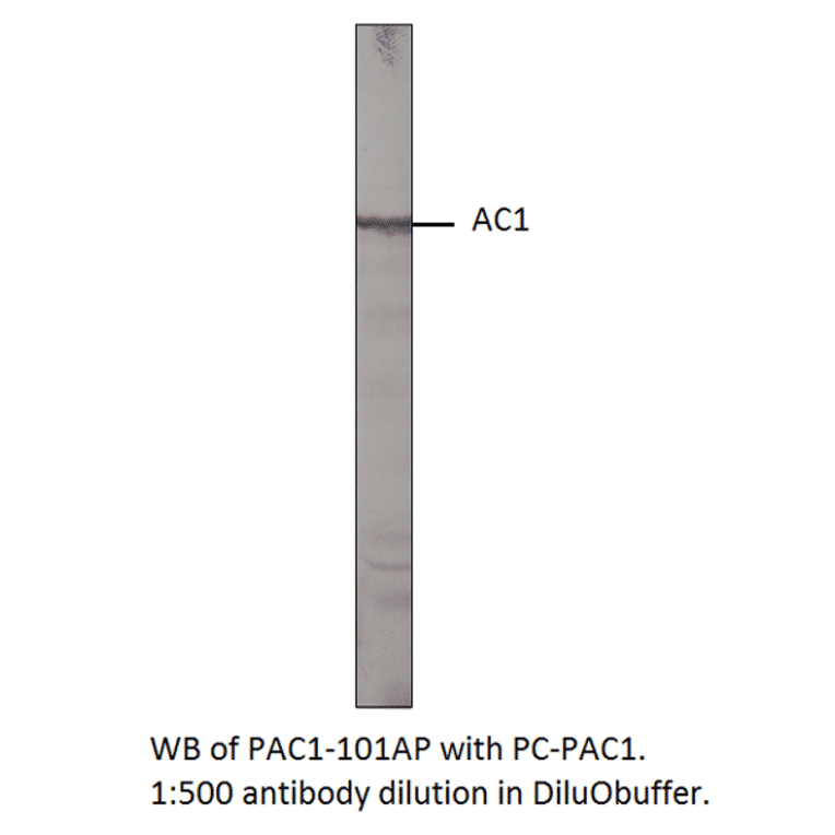 Anti-Adenylate cyclase 1 Antibody from FabGennix (PAC-101AP) - Antibodies.com