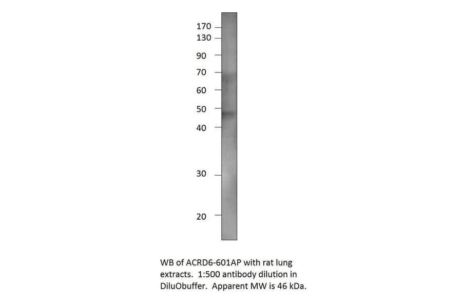 Anti-Atypical Chemokine Receptor D6 Antibody from FabGennix (ACRD6-601AP) - Antibodies.com