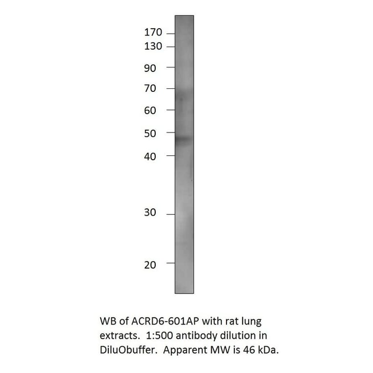 Anti-Atypical Chemokine Receptor D6 Antibody from FabGennix (ACRD6-601AP) - Antibodies.com