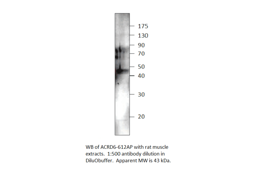 Anti-Atypical Chemokine Receptor D6 Antibody from FabGennix (ACRD6-612AP) - Antibodies.com
