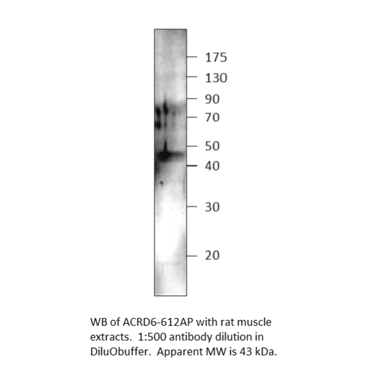 Anti-Atypical Chemokine Receptor D6 Antibody from FabGennix (ACRD6-612AP) - Antibodies.com
