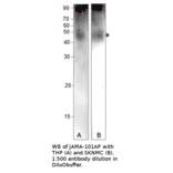 Anti-Junctional Adhesion Molecule 1 Antibody from FabGennix (JAMA-101AP) - Antibodies.com