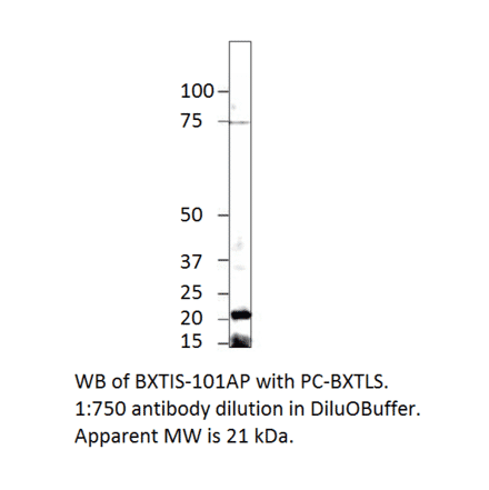 Anti-Beta crystallin S Antibody from FabGennix (BXTL-201AP) - Antibodies.com