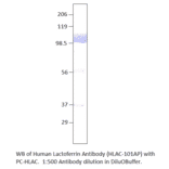 Anti-Human Lactoferrin Antibody from FabGennix (HLAC-101AP) - Antibodies.com