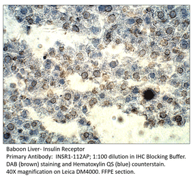 Anti-Insulin Receptor Antibody from FabGennix (INSR1-112AP) - Antibodies.com