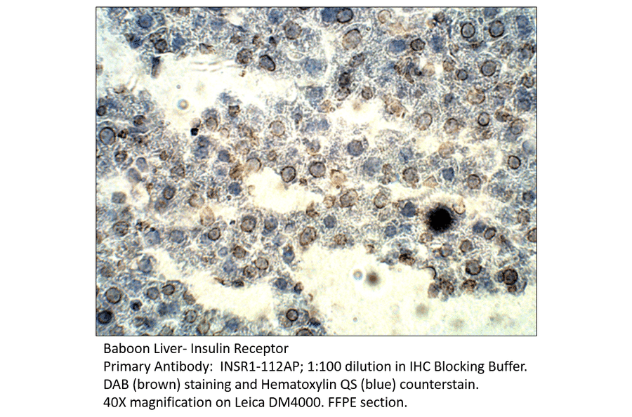Anti-Insulin Receptor Antibody from FabGennix (INSR1-112AP) - Antibodies.com