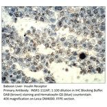 Anti-Insulin Receptor Antibody from FabGennix (INSR1-112AP) - Antibodies.com