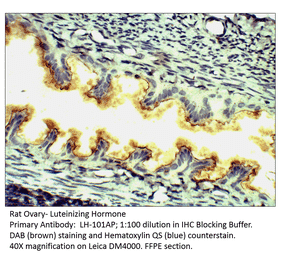 Anti-Luteinizing Hormone Antibody from FabGennix (LH-101AP) - Antibodies.com