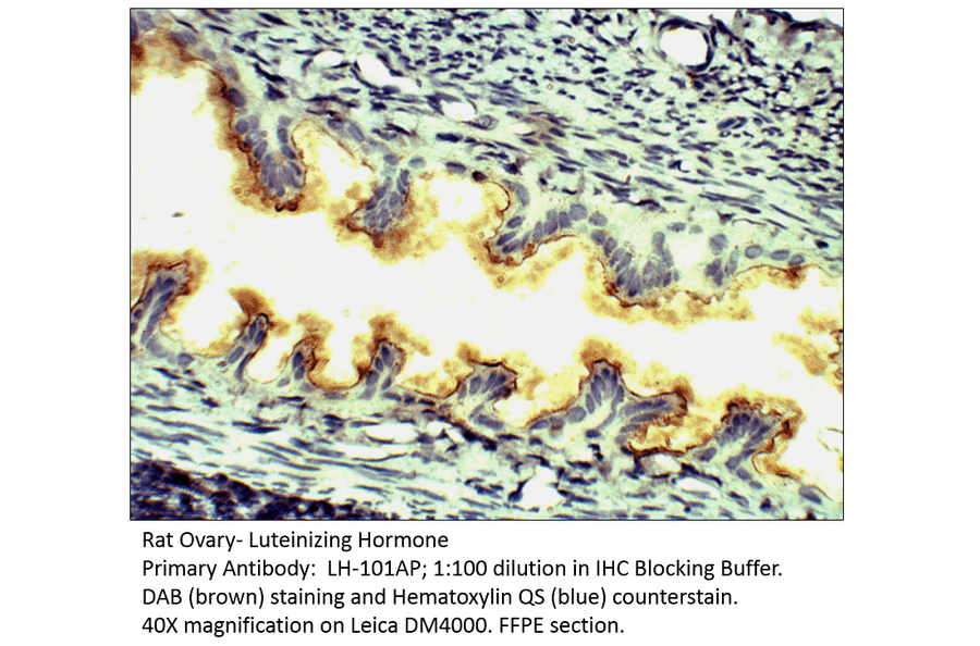 Anti-Luteinizing Hormone Antibody from FabGennix (LH-101AP) - Antibodies.com