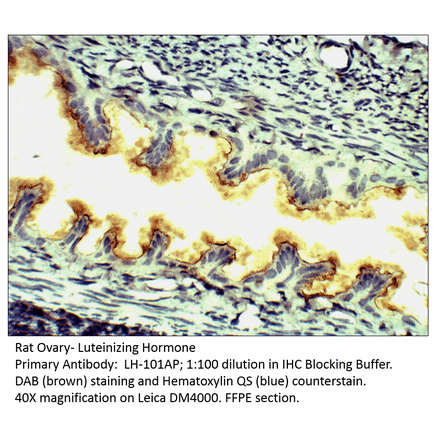 Anti-Luteinizing Hormone Antibody from FabGennix (LH-101AP) - Antibodies.com