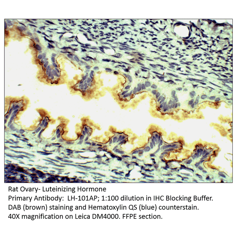 Anti-Luteinizing Hormone Antibody from FabGennix (LH-101AP) - Antibodies.com