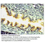 Anti-Luteinizing Hormone Antibody from FabGennix (LH-101AP) - Antibodies.com