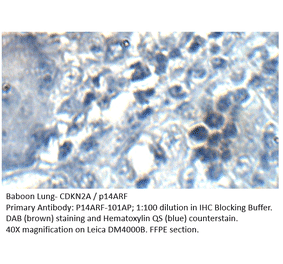 Anti-CDKN2A / p14ARF Antibody from FabGennix (P14ARF-101AP) - Antibodies.com