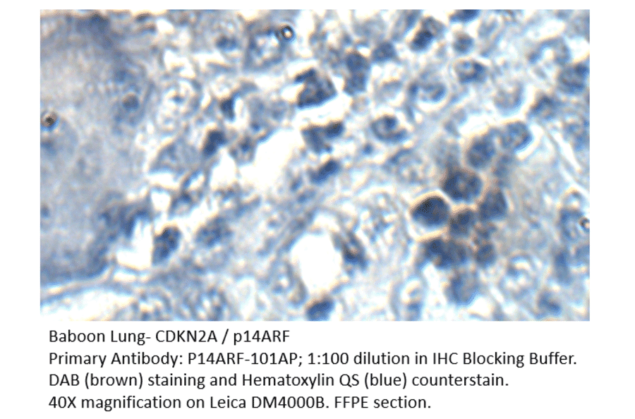 Anti-CDKN2A / p14ARF Antibody from FabGennix (P14ARF-101AP) - Antibodies.com