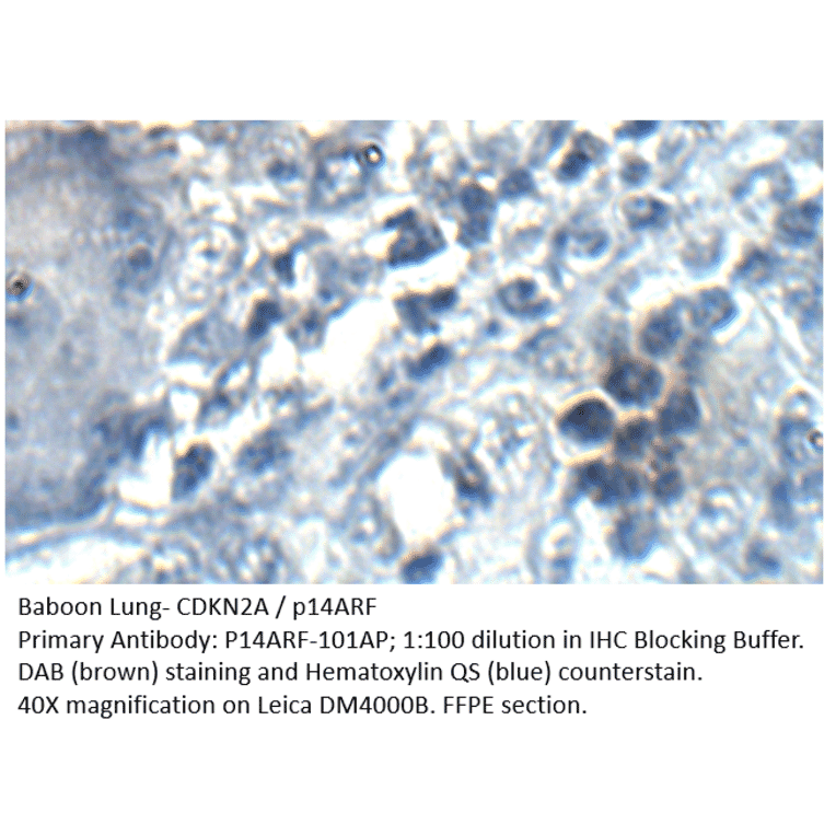 Anti-CDKN2A / p14ARF Antibody from FabGennix (P14ARF-101AP) - Antibodies.com