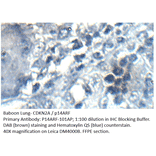 Anti-CDKN2A / p14ARF Antibody from FabGennix (P14ARF-101AP) - Antibodies.com