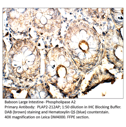 Anti-Phospholipase A2 Antibody from FabGennix (PLAP2-212AP) - Antibodies.com