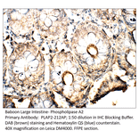 Anti-Phospholipase A2 Antibody from FabGennix (PLAP2-212AP) - Antibodies.com