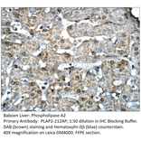 Anti-Phospholipase A2 Antibody from FabGennix (PLAP2-212AP) - Antibodies.com