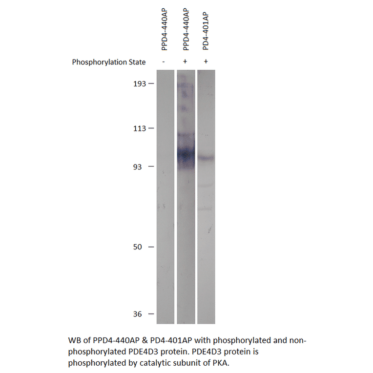 Anti-Phospho-PDE4D PKA site (S190) Antibody from FabGennix (PPD4-440AP) - Antibodies.com