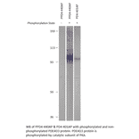 Anti-Phospho-PDE4D PKA site (S190) Antibody from FabGennix (PPD4-440AP) - Antibodies.com