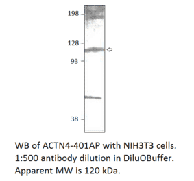 Anti-alpha Actinin 4 Antibody from FabGennix (ACTN4-401AP) - Antibodies.com
