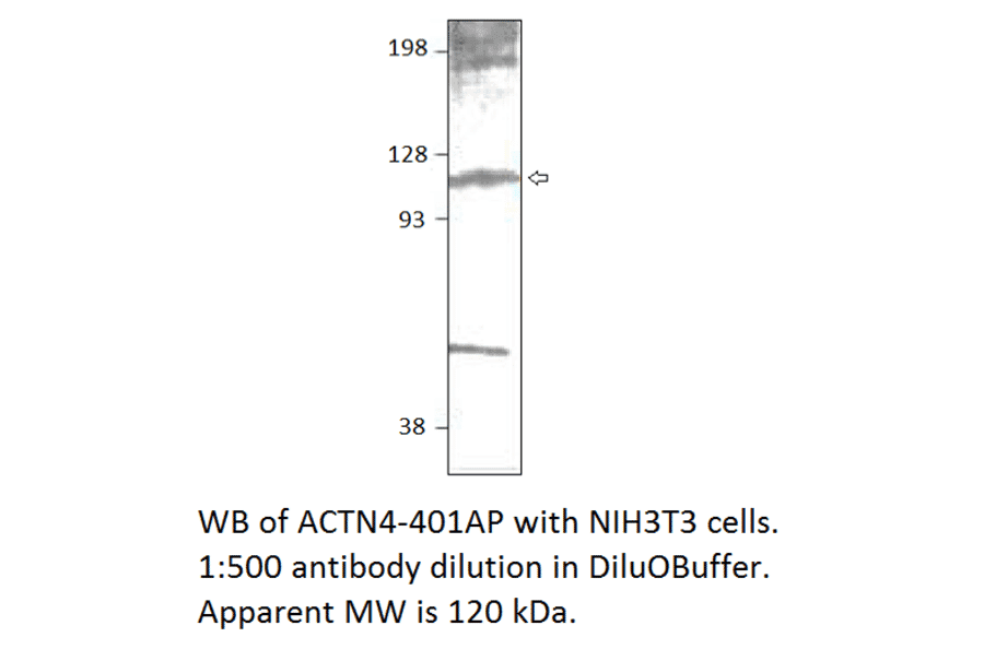Anti-alpha Actinin 4 Antibody from FabGennix (ACTN4-401AP) - Antibodies.com