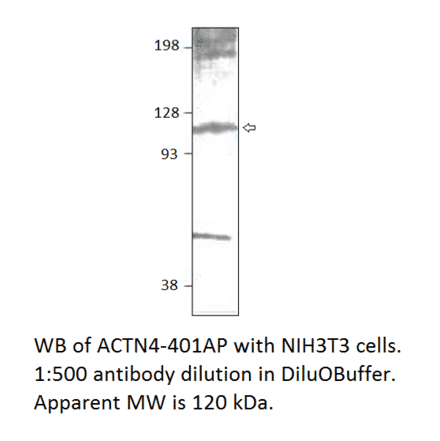 Anti-alpha Actinin 4 Antibody from FabGennix (ACTN4-401AP) - Antibodies.com