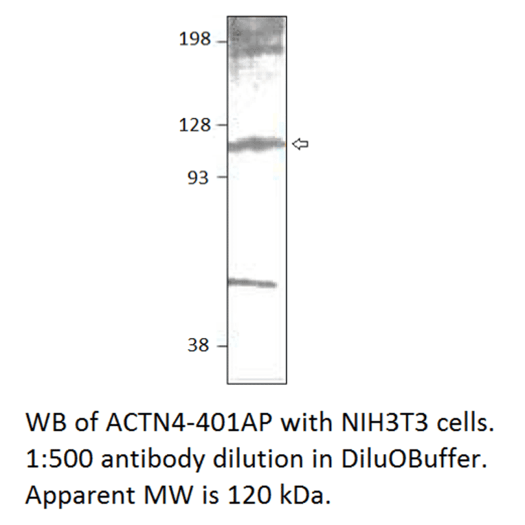 Anti-alpha Actinin 4 Antibody from FabGennix (ACTN4-401AP) - Antibodies.com