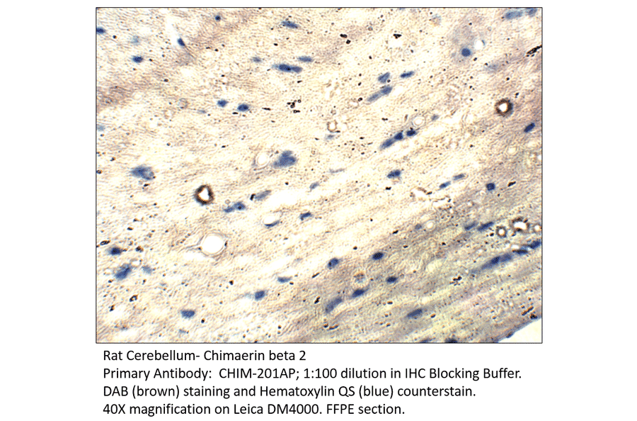Anti-Chimaerin beta 2 Antibody from FabGennix (CHIM-201AP) - Antibodies.com