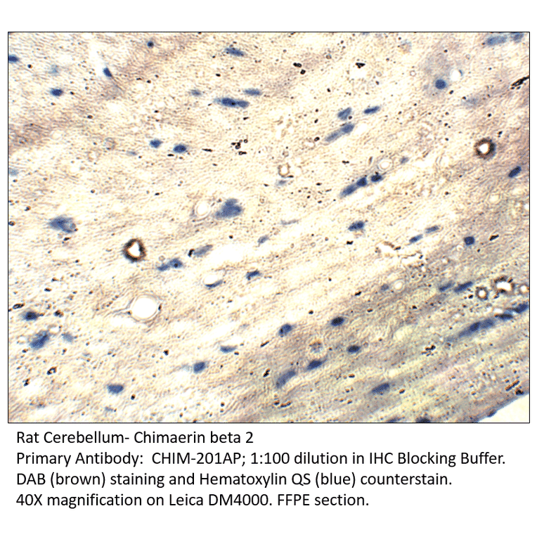 Anti-Chimaerin beta 2 Antibody from FabGennix (CHIM-201AP) - Antibodies.com