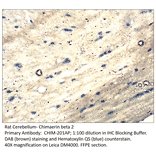 Anti-Chimaerin beta 2 Antibody from FabGennix (CHIM-201AP) - Antibodies.com