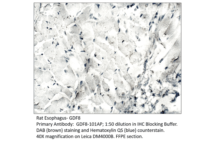 Anti-GDF8 / Myostatin Antibody from FabGennix (GDF8-801AP) - Antibodies.com