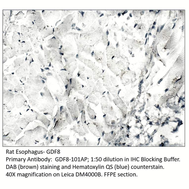 Anti-GDF8 / Myostatin Antibody from FabGennix (GDF8-801AP) - Antibodies.com