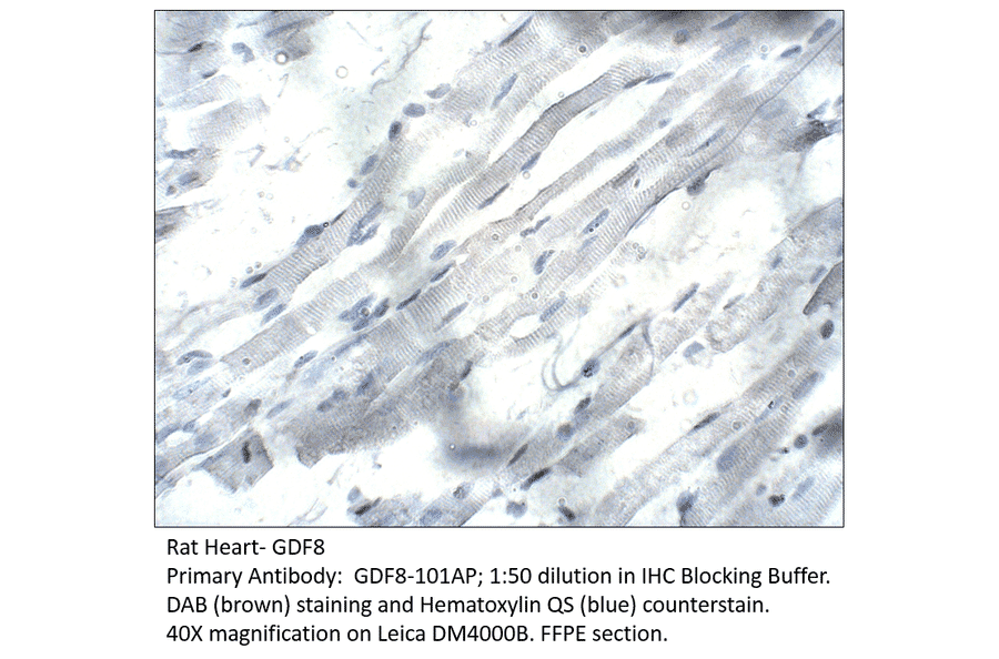 Anti-GDF8 / Myostatin Antibody from FabGennix (GDF8-801AP) - Antibodies.com