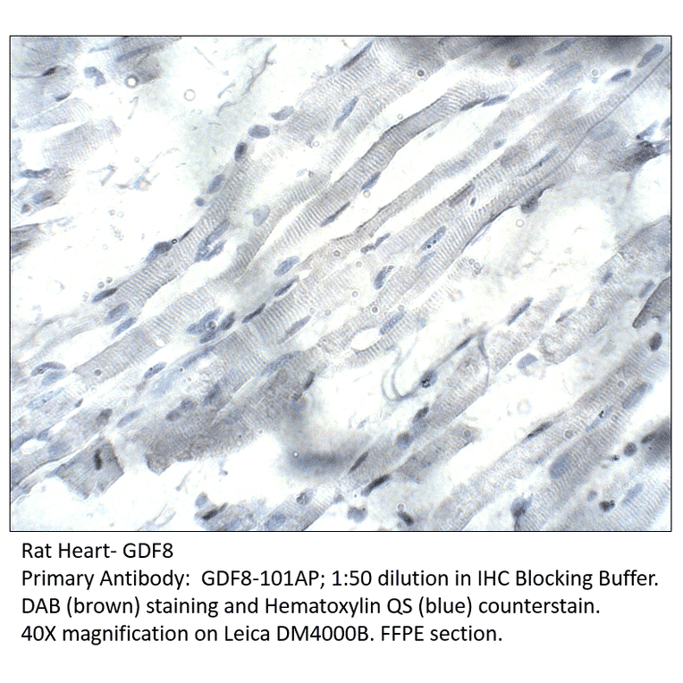 Anti-GDF8 / Myostatin Antibody from FabGennix (GDF8-801AP) - Antibodies.com