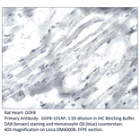 Anti-GDF8 / Myostatin Antibody from FabGennix (GDF8-801AP) - Antibodies.com