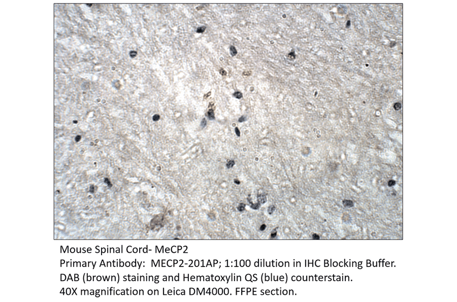 Anti-MeCP2 isoform 2 Antibody from FabGennix (MECP2-201AP) - Antibodies.com