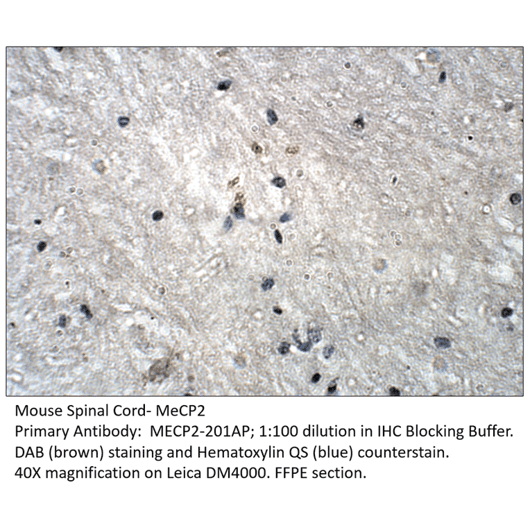 Anti-MeCP2 isoform 2 Antibody from FabGennix (MECP2-201AP) - Antibodies.com