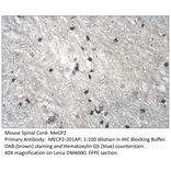 Anti-MeCP2 isoform 2 Antibody from FabGennix (MECP2-201AP) - Antibodies.com