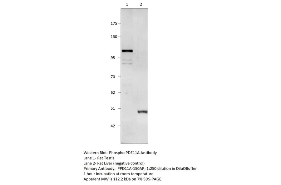 Anti-Phospho-PDE11A Antibody (S117 & S124) from FabGennix (PPD11A-150AP) - Antibodies.com