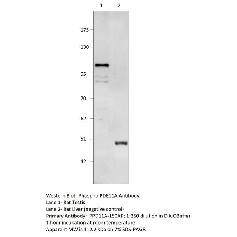 Anti-Phospho-PDE11A Antibody (S117 & S124) from FabGennix (PPD11A-150AP) - Antibodies.com