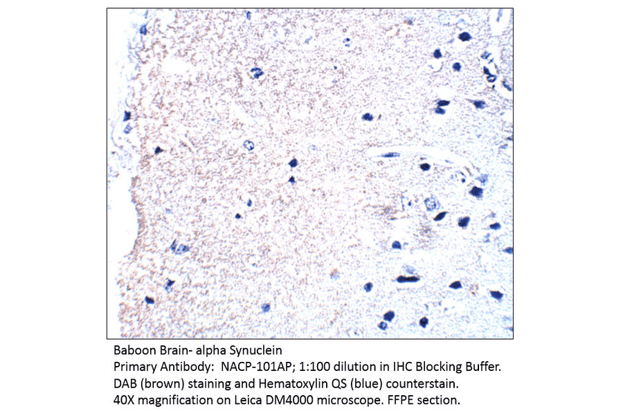 Anti-Alpha Synuclein Antibody from FabGennix (NACP-101AP) - Antibodies.com