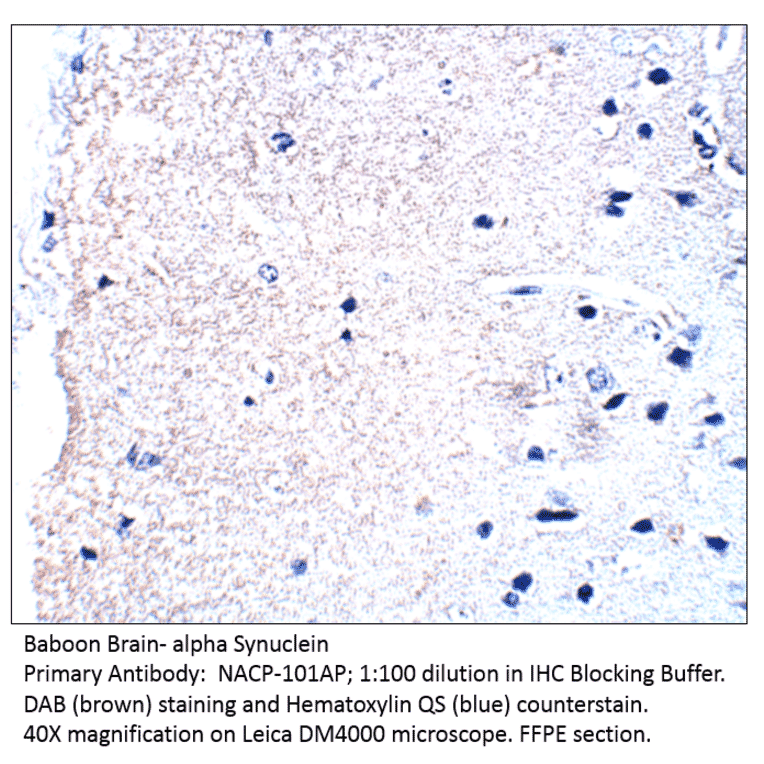 Anti-Alpha Synuclein Antibody from FabGennix (NACP-101AP) - Antibodies.com