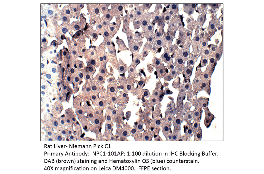 Anti-Niemann Pick C1 Antibody from FabGennix (NPC1-101AP) - Antibodies.com