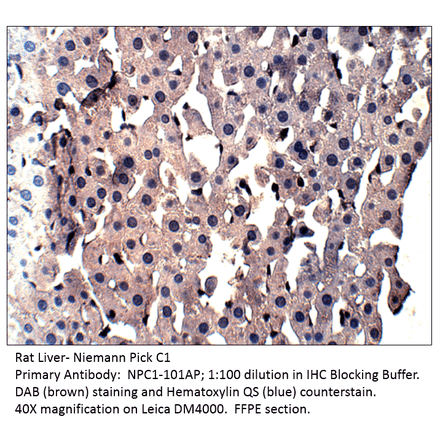 Anti-Niemann Pick C1 Antibody from FabGennix (NPC1-101AP) - Antibodies.com