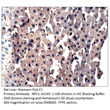 Anti-Niemann Pick C1 Antibody from FabGennix (NPC1-101AP) - Antibodies.com