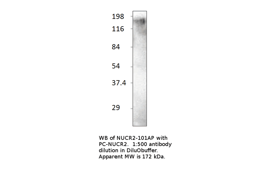 Anti-KAT13C / NCOA2 Antibody from FabGennix (NUCR2-101AP) - Antibodies.com